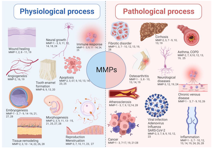 Nicolas Babault (@nbabault) on Twitter photo New collaborative paper #Brasilia_Dijon: Involvement of Matrix Metalloproteinases in COVID: Molecular Targets, Mechanisms, and Insights for Therapeutic Interventions mdpi.com/2336230 #mdpibiology via <a href="/Biology_MDPI/">Biology MDPI</a> <a href="/RitaMarqueti/">Rita de Cássia Marqueti Durigan</a> <a href="/DuriganJL/">João Durigan</a> <a href="/CepCometti/">CEPCometti</a> <a href="/ufrstaps_dijon/">UFR STAPS Dijon - Le Creusot</a> New collaborative paper #Brasilia_Dijon: Involvement of Matrix Metalloproteinases in COVID: Molecular Targets, Mechanisms, and Insights for Therapeutic Interventions mdpi.com/2336230 #mdpibiology via <a href="/Biology_MDPI/">Biology MDPI</a> <a href="/RitaMarqueti/">Rita de Cássia Marqueti Durigan</a> <a href="/DuriganJL/">João Durigan</a> <a href="/CepCometti/">CEPCometti</a> <a href="/ufrstaps_dijon/">UFR STAPS Dijon - Le Creusot</a>