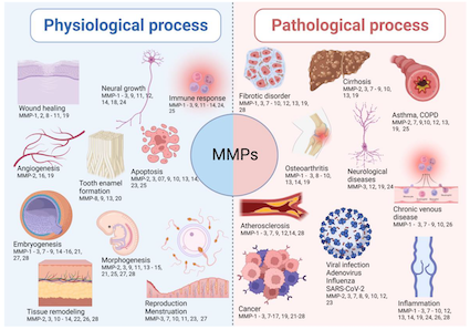 New collaborative paper #Brasilia_Dijon: Involvement of Matrix Metalloproteinases in COVID: Molecular Targets, Mechanisms, and Insights for Therapeutic Interventions mdpi.com/2336230 #mdpibiology via @Biology_MDPI @RitaMarqueti @DuriganJL @CepCometti @ufrstaps_dijon