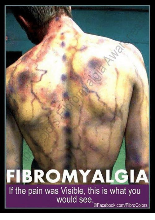 #Fibromyalgia