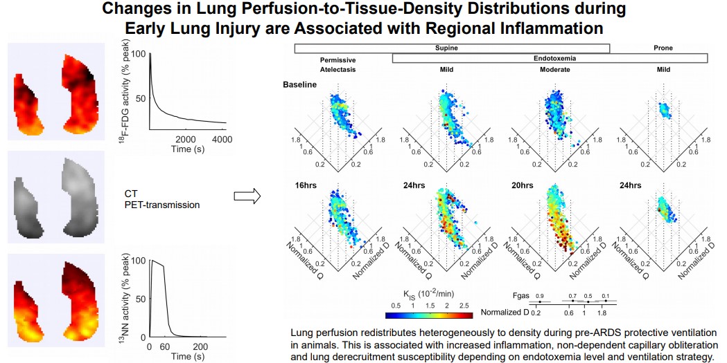 japplphysiol's tweet photo. #ArticlesInPresS “Worsening of Lung Perfusion to Tissue Density Distributions during Early Acute Lung Injury at Different Physiological Conditions” 

Gabriel C. Motta-Ribeiro et al. 
🖱️https://t.co/tzXLmIgWyi
#JAPPL #PerfusionImaging @Eduardo31367306 https://t.co/LITzIy0fhm