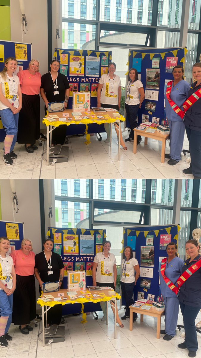 ethomasuo's tweet photo. Brilliant day today supporting the tissue viability team at Kings Mill! Despite us all melting in the heat, we’ve had a great day 🔥 #legsmatter #legsgo #urgo #urgoktwo https://t.co/OdYf0KovLu