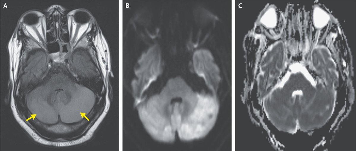 NEJM tweet picture