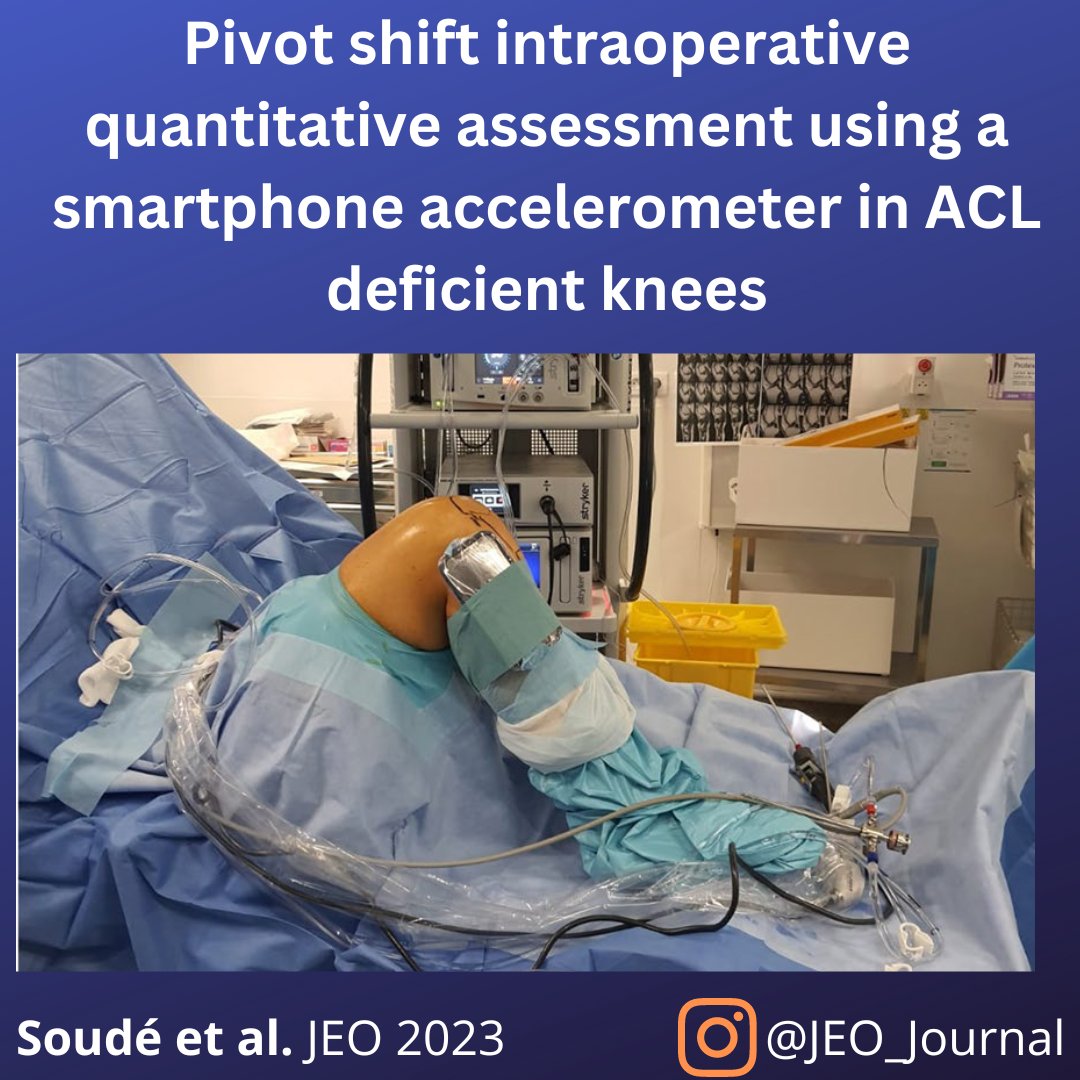 JEO_journal's tweet image. A smartphone accelerometer can be used for measuring pivot shift intraoperatively!
How to do it?
Let&apos;s take a look at OPEN ACCESS article: doi.org/10.1186/s40634…

#ACL #pivotshift #smartphone #accelerometer
