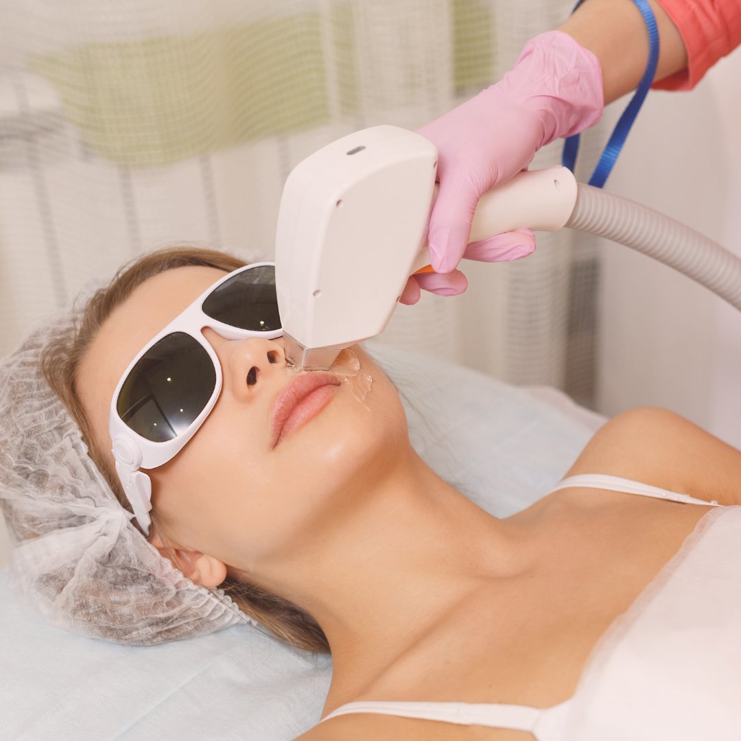 infinity_laser's tweet photo. Laser hair removal works on all skin tones and hair colors. Although the sharper the skin-to-hair contrast the better, our laser machines can pick up dark hair on dark skin and fair hair on light skin.

_ #laserhairremoval #laserhairremovaltreatment #laserhair #homelaserhairremo https://t.co/hQw3cfDgQ7