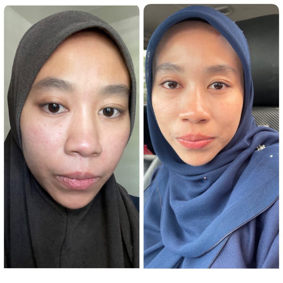 ctfahida's tweet photo. Kulit kusam pun jadi auto glowing hanya dengan cream viral WDAC https://t.co/eO91VPYsnY
