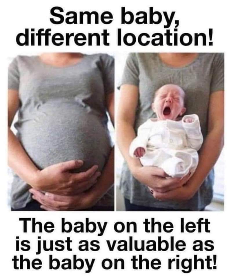 MurdoMMK's tweet photo. @BPAS1968 What kind of society treats babies this way! https://t.co/lXWdQof6hl