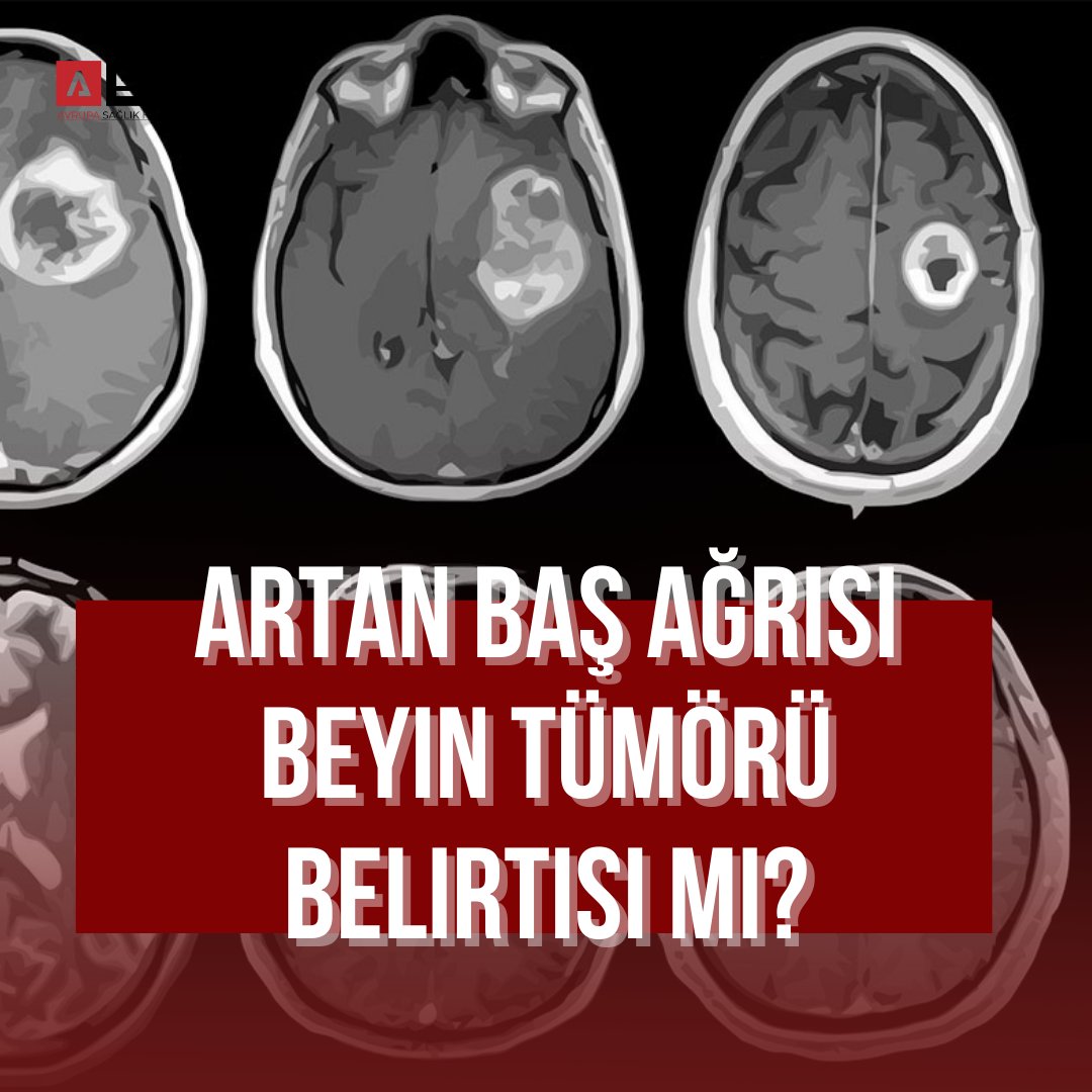 Artan baş ağrısı beyin tümörü belirtisi mi?

Haberin devamını okumak için sitemize göz atabilirsiniz..

avrupasaglikhaberleri.com
#avrupasağlık #sağlıkhaberleri #sağlıkhaberleri #sağlikhaberleri̇ #sağlıkhaberciliği #beyintümörü #başağrısı