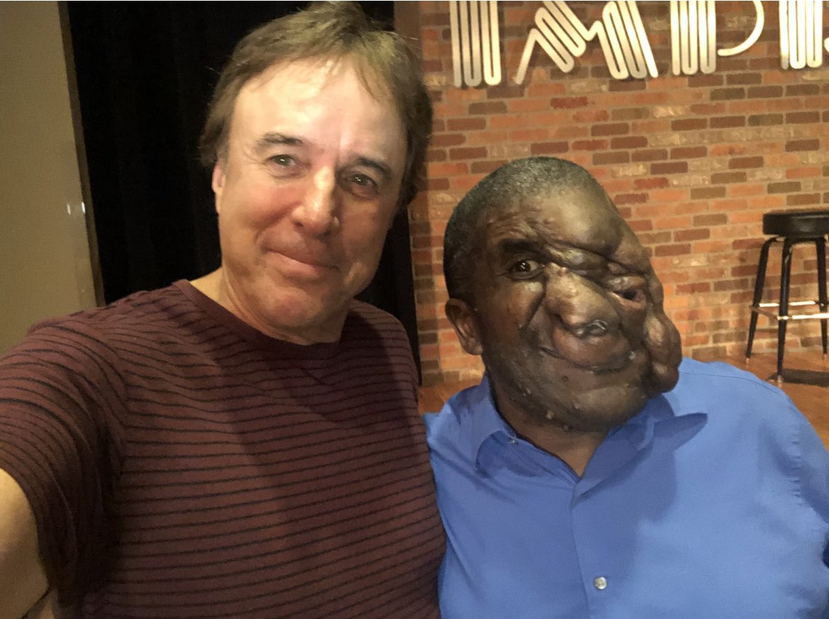 This is my friend Reggie Bibbs. Reggie is the kindest and most loving person I have ever met. His face is disfigured from a rare genetic condition called ‘Neurofibromatosis.’ After many years of never leaving his bedroom, out of shame and embarrassment, Reggie finally summoned