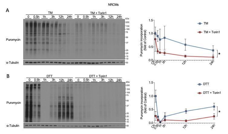AJP-Heart and Circ (@ajpheartcirc) on Twitter photo #ArticlesInPress: mTORC1 inhibition impairs activation of the unfolded protein response and induces cell death during ER stress in #cardiomyocytes
(Hofmann et al)
ow.ly/cysr50OLKnI
<a href="/Shirin_Dor/">Shirin Doroudgar</a> @ChrlsHofmann <a href="/UniHeidelberg/">Uni Heidelberg</a>
#mTORC1 #ER stress #ATF6 #ArticlesInPress: mTORC1 inhibition impairs activation of the unfolded protein response and induces cell death during ER stress in #cardiomyocytes
(Hofmann et al)
ow.ly/cysr50OLKnI
<a href="/Shirin_Dor/">Shirin Doroudgar</a> @ChrlsHofmann <a href="/UniHeidelberg/">Uni Heidelberg</a>
#mTORC1 #ER stress #ATF6