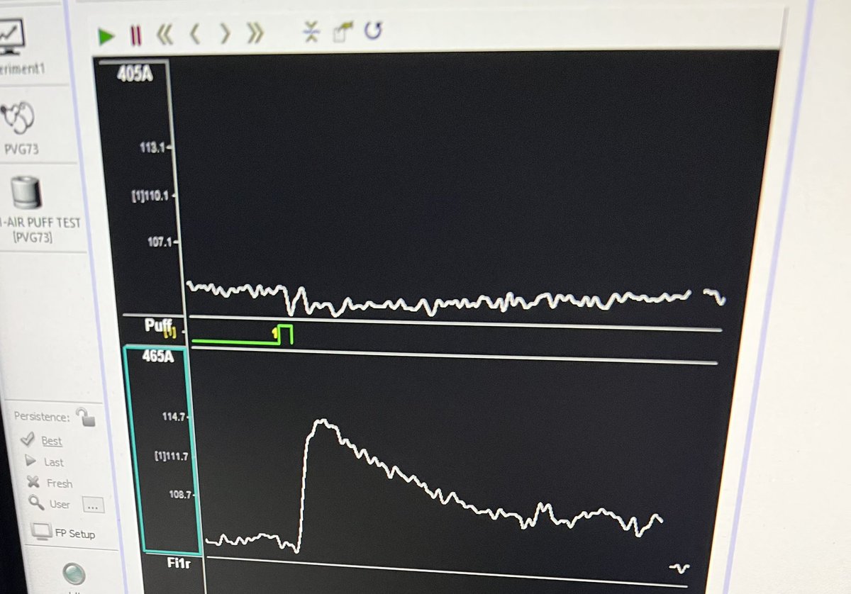 We love a potent stimulus and clean signal 😍 #fiberphotometry #psychedelics