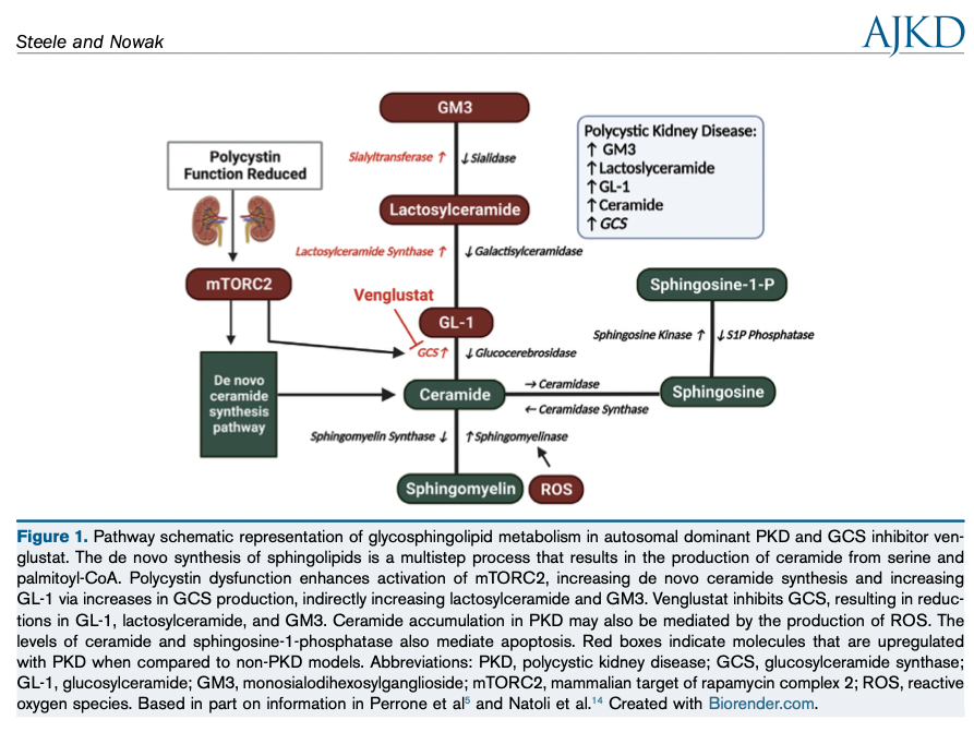 @RonGansevoort @ABCrenalarena @bertperso Editorial by @CortneySteele and @KristenlNowak: Targeting Glycosphingolipid Metabolism in ADPKD: Another Roadblock for Treatment bit.ly/3Na8BxU (FREE) @CU_Kidney