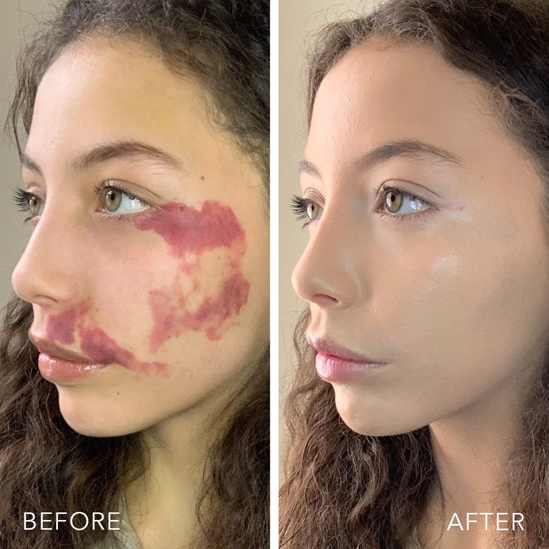 doll10beauty's tweet photo. It's BACKKK! Dollskin Genius Serum Skin Tint with Reishi Mushroom is back in stock after selling out on https://t.co/xGZHiArGsM and on HSN!
We don't calll this #SkinMagic for no reason! https://t.co/V5cAA8ULp1