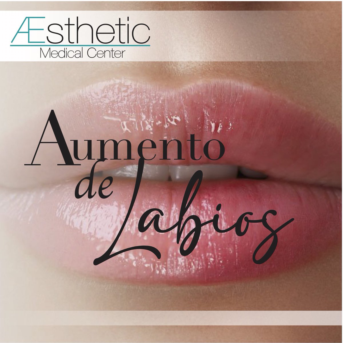 AestheticMC's tweet photo. Al decidirse por el aumento de labios es importante la elección del producto ideal , lo cual, aunado al expertise del médico, tendrá como resultado una apariencia muy natural y estética. 

#aumentodelabios #lipsjob #dermafillers #perfectlips #medicinaestetica https://t.co/Fyetmk3MWv