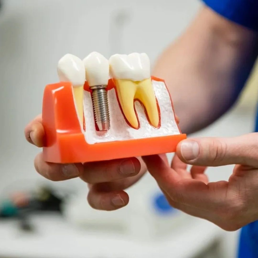 Ready for a dental upgrade? Laser endodontics brings the latest in dental technology to the table, making root canals faster, more comfortable, and less intimidating than ever before. #ViennaEndodontist