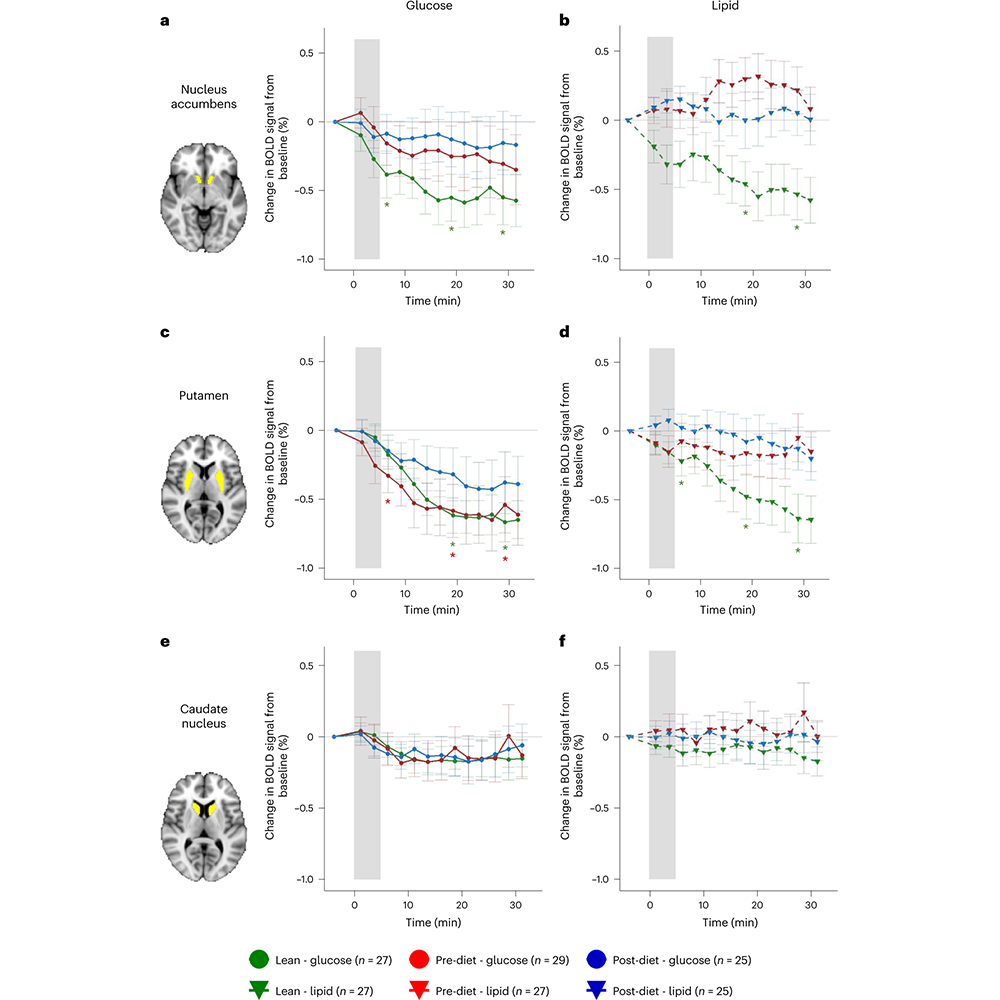 Brain responses to specific nutrients are diminished in people with obesity and are not improved after weight loss, according to a study in @NatMetabolism. The findings suggest that long-lasting brain adaptations may take place in people with obesity. go.nature.com/3oYPCy5