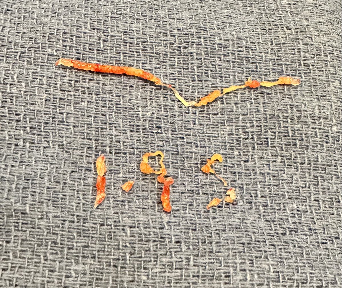 jcgeorgemd's tweet photo. #PVICaseFiles #PlaqueArt from #PennsyInterventions: depicting current conditions in @CityofPhila after a collapsed bridge on I-95! The second pic even shows smoke from the tanker π₯ Any ideas for additional plaque? @PennCardiology @PennCVFellows @GPAngioClub @ACVCPhila @ReVascMed https://t.co/gJPUWsFQbp