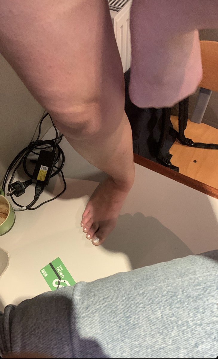 CrienCtweeter's tweet photo. Ohhh tout les bouffeurs de pieds là jugez ma pote svp elle fait que m’envoyer ses pieds c’est une horreur
#fetichiste #grospanard https://t.co/ZwwJOVW9XT