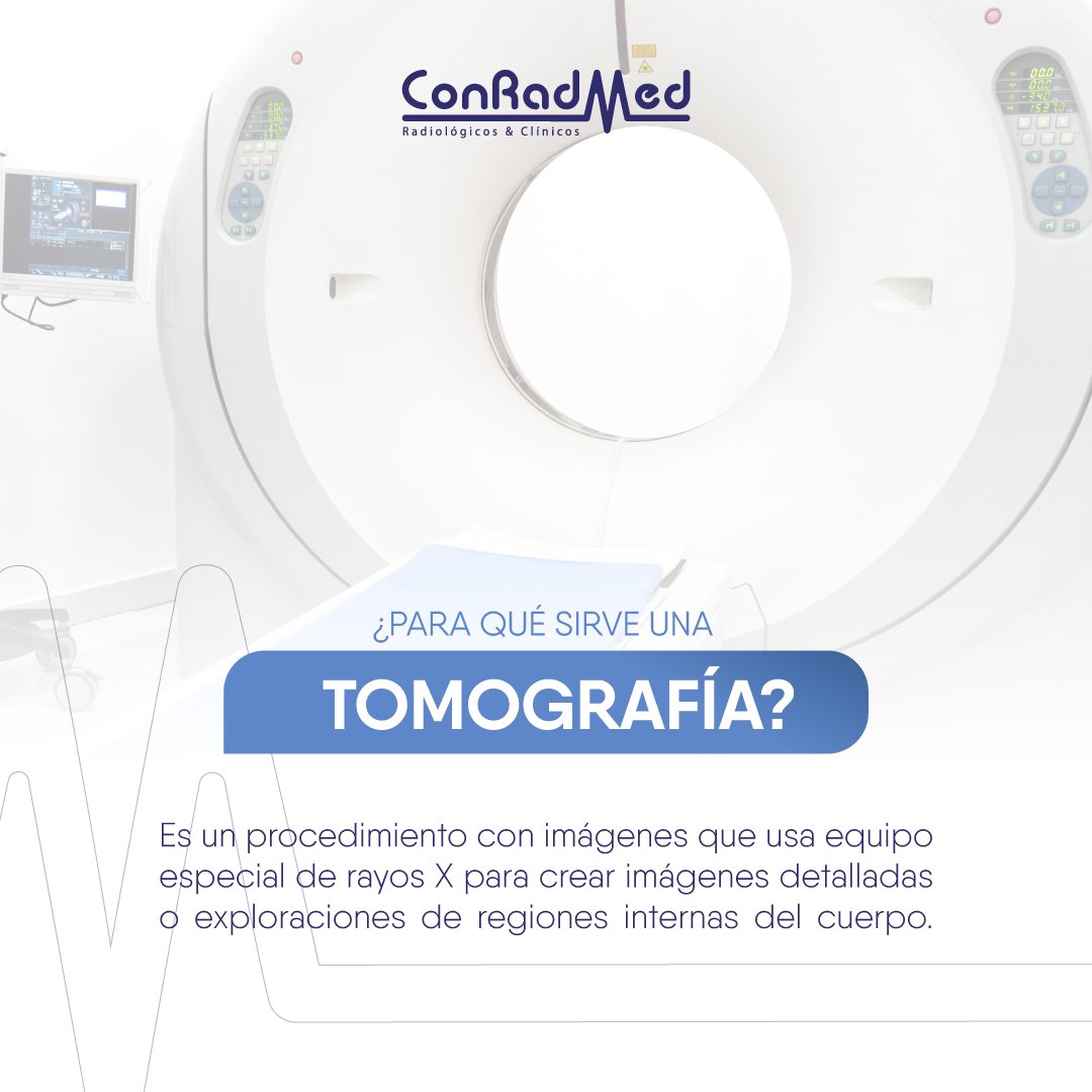 ConRadMed's tweet image. La tomografía es una gran aliada de la medicina, el apoyo que brinda se ha vuelto indispensable para el correcto diagnostico del paciente. 

Agenda vía WhatsApp: bit.ly/3vy8V1c
Teléfonos: 99 88 84 74 01 | 99 88 84 73 88