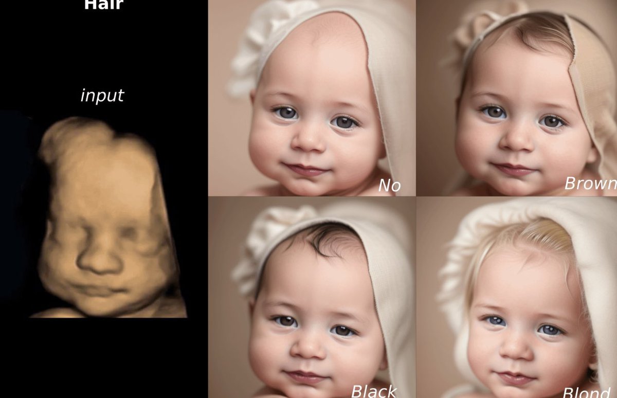 🤩 De l’écho à la photo de portrait de bébé 

Imaginez des images échographiques 3D/4D qui renaissent sous forme de représentations réalistes, grâce aux prouesses remarquables de l'IA ‼️

Pour tester : photorealisticultrasound.com

v/ <a href="/rowancheung/">Rowan Cheung</a>