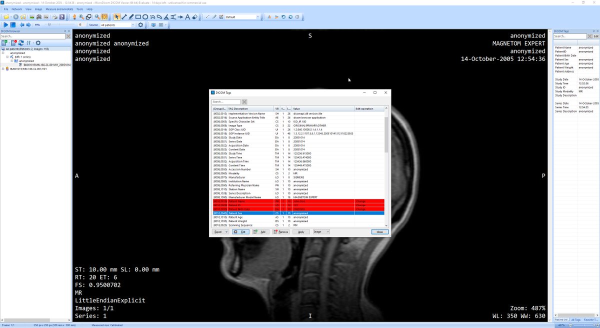 microdicom's tweet photo. MicroDicom DICOM Viewer 2023.2 is ready for download.
Fully functional DICOM editor. https://t.co/pvMBkgG2ov