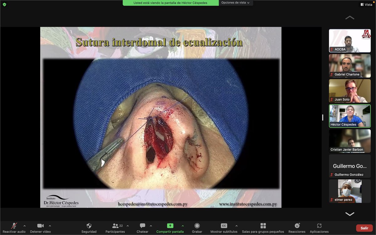 GCharloneGran's tweet photo. Gracias a los Dres. Héctor Cespedes, Cristian Barbón y Juan Soto por su participación en el primer Webinar conjunto entre AOCBA y SORLU. Junto con el Dr. Nazareno Riolfi agradecemos su contribución a la formación continua en el tema sobre Manejo de la Punta Nasal. https://t.co/ceh4Q7Ms4A