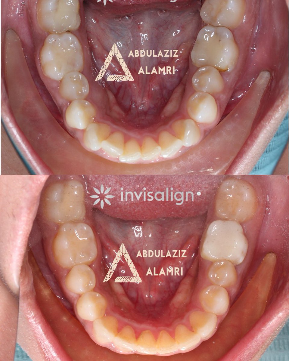إهداء لأصحاب الابتسامات الجميلة #ابتسم
#الشرقية ✨✨