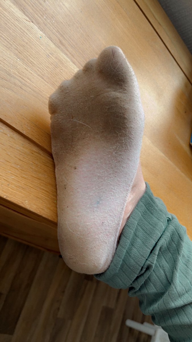 Bethhy121's tweet photo. Filthy, sweaty size 5s 🤭

#feet #dirtyfeet #sweaty https://t.co/upUqIce5w0