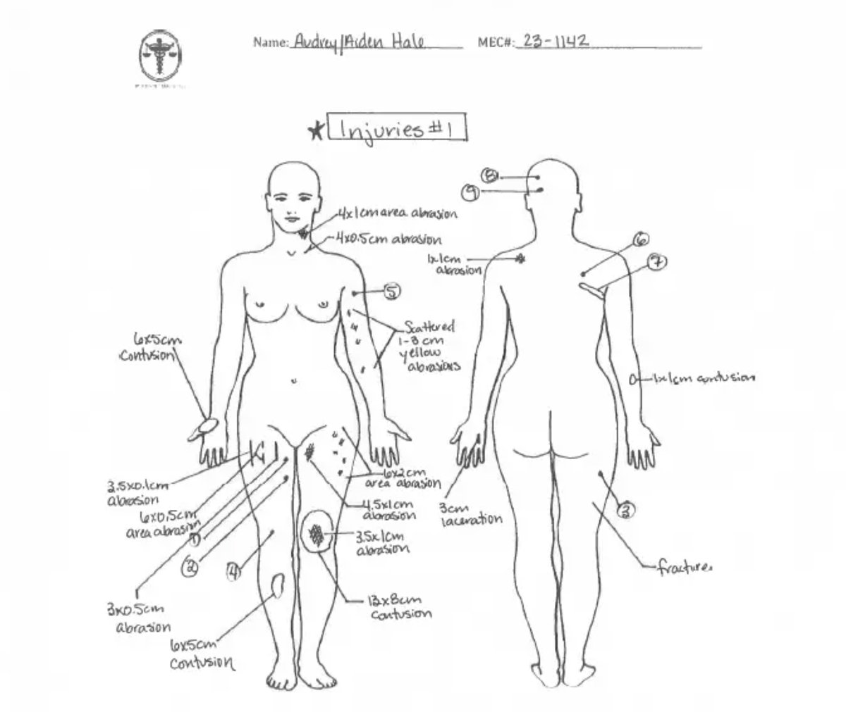 One can deny biological reality until you can't. 

Autopsy report of Audrey 'Aiden' Hale, the #trans Nashville Christian school shooter: 'The body is that of a well-developed, well-nourished 5 foot 2 inch, 119-1/2 pound phenotypic female'

Credit to @MiaCathell for obtaining the…