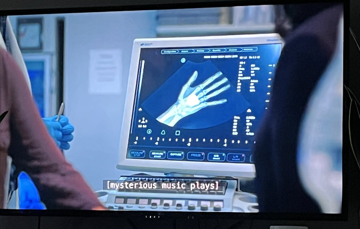 XrayProblems's tweet photo. The ultrasound machine on @ManifestNFLX s4ep15 magically gave us a hand xray !
#xrayprobs #medtv #medical #manifest #radiology https://t.co/vk9hPvjyyX