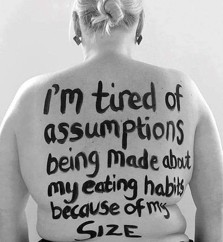 Powerful & True👇🏻 we need to educate the complexities of #obesity & #standuptoweightstigma You may not witness stigma & bias but that doesn’t mean it doesn’t exist @AboutObesityorg @obesityactionsc @xandvt @BBCMorningLive @ObesityEmpower @SOBAuk