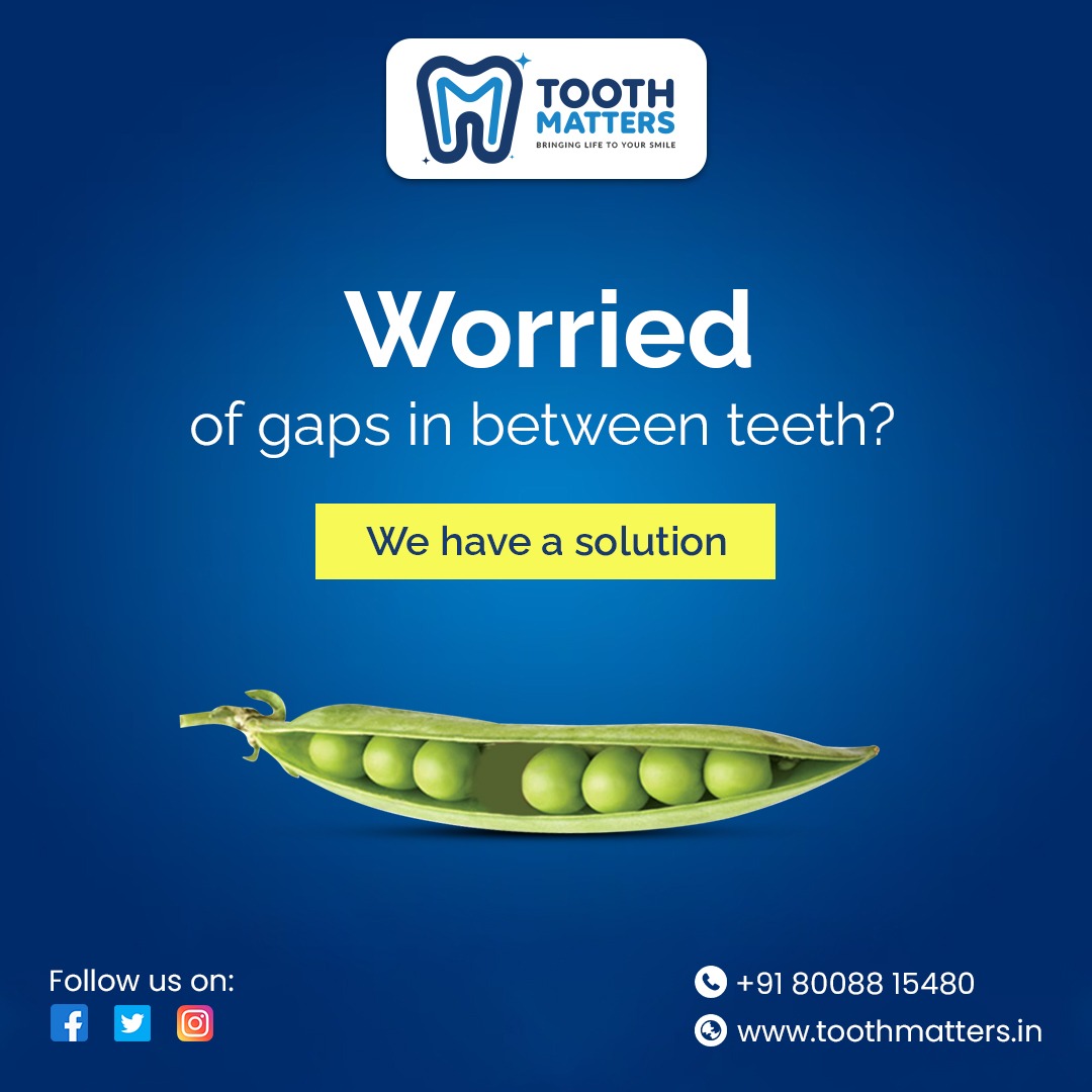 tooth_matters's tweet image. Are you worried of tooth gaps ? Explore the best treatment options for tooth gaps at Tooth Matters. consult is today .
Dr. Sravanthi Y
BDS , MDS (Endodontics)
Root Canal Specialist
Website : toothmatters.in
  #toothgap #gaptooth #smilegap #teethgap   #smilewithconfidence