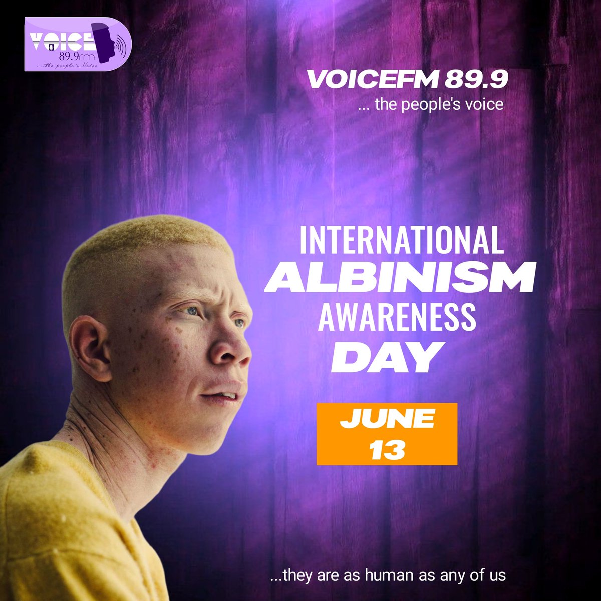 International albinism awareness day June 13