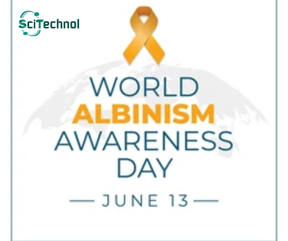 scitechnol3's tweet photo. #InternationalAlbinismAwarenessDay  is June 13th. Today, we intend to raise awareness of albinism and promote their right to live with dignity and respect, as well as to recognize the beauty and strength of those with albinism.
#IAAD2023 #SupportAlbinism https://t.co/I0pALpc5x2