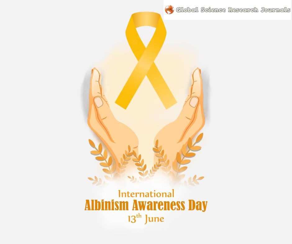 global_sciecne's tweet photo. Awareness
Today is ALBINISM DAY all across the world. Let us respect each other's rights; we can overcome any difficulty if we work together.

#albinismawarenessday #AlbinismAwarenessDay #IAAD2023 #SupportAlbinism https://t.co/0or1fF4hrO