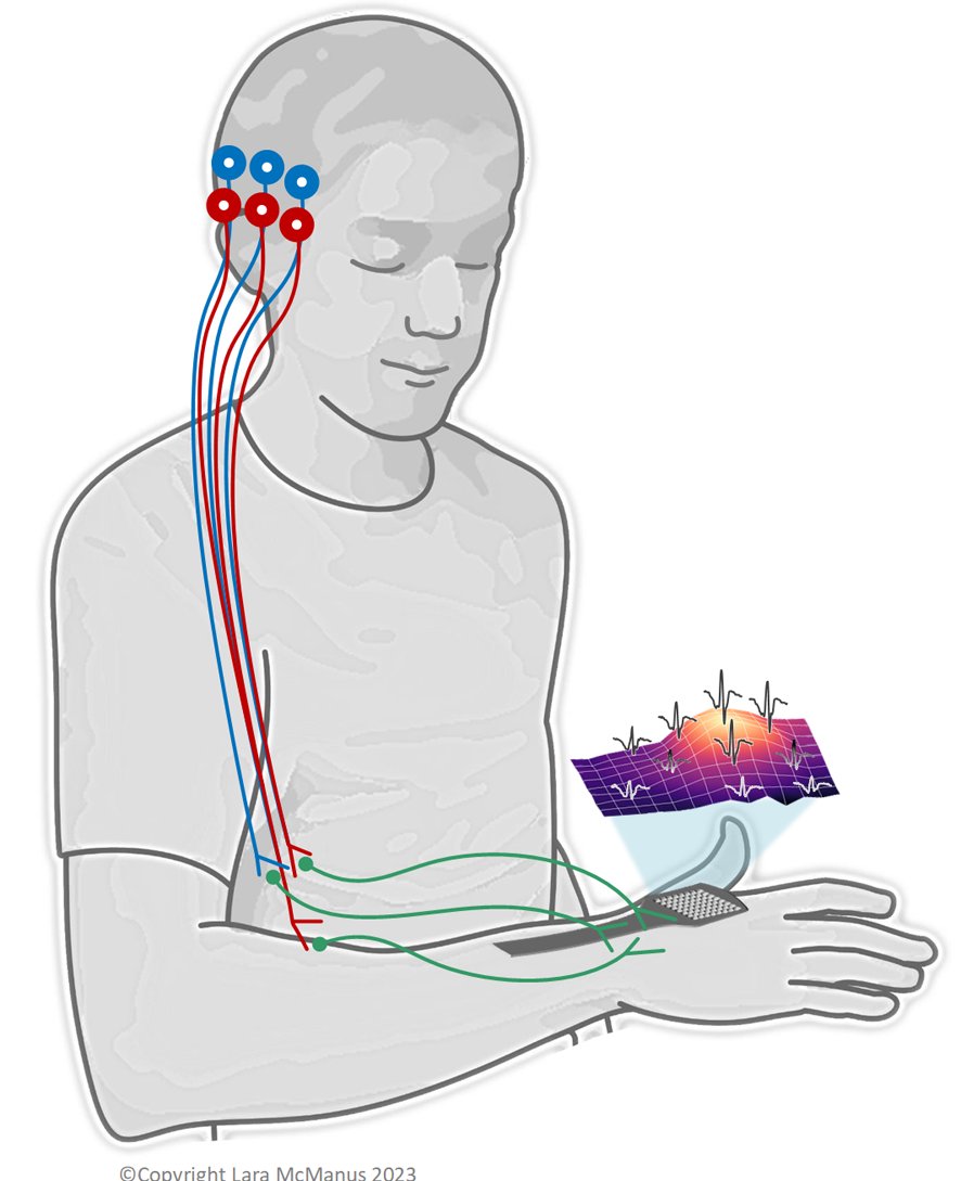 🚨 Research Assistant Post 🚨

Seeking an RA for an exciting new project that will use high density #EMG and #EEG to examine changes in neuroelectric signalling in #ALS. 🧠 For more information see #TCD jobs and bit.ly/3JxMRLp