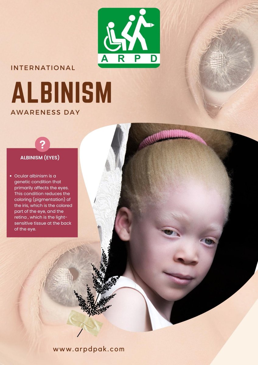 HHCSARPD's tweet photo. INTERNATIONAL ALBINISM AWARENESS DAY
#ARPD #HHCS #internationalalbinism https://t.co/pJNnVB8dAD