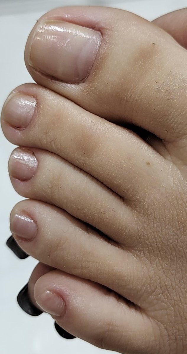 DiegoAndrey90's tweet image. #Lizz pies