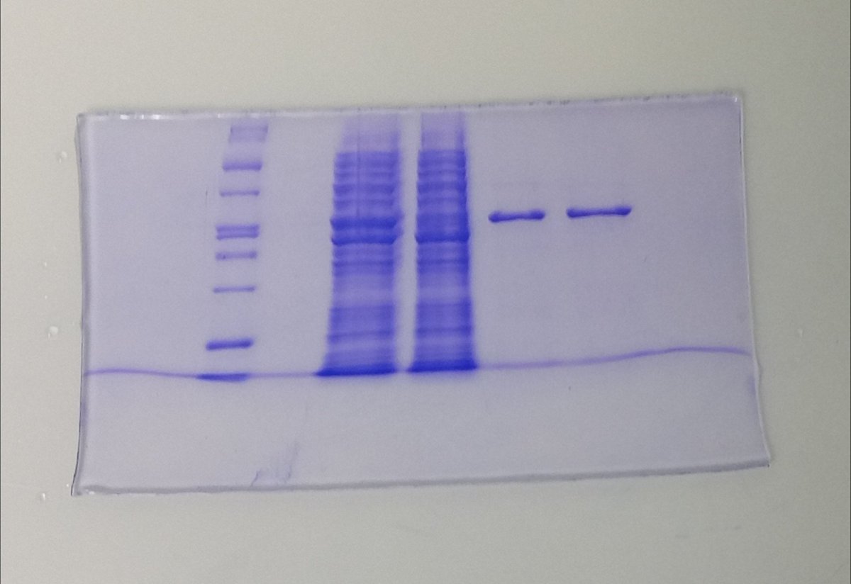 Learning a new skill requires a certain level of humility, patience and maturity. As I transition from Synthetic Organic Chemistry to Biochemistry these qualities have been helpful in this exciting journey.
