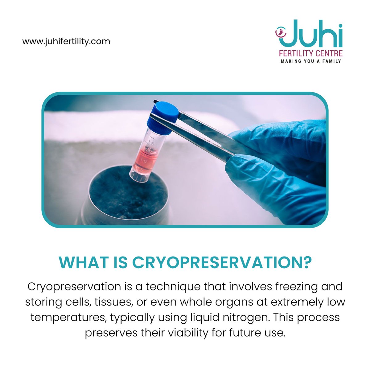 Dive into the fascinating realm of cryopreservation and witness the magic it holds. ❄️✨This remarkable technique involves freezing and storing cells, tissues, and even entire organs at ultra-low temperatures, courtesy of liquid nitrogen.
#ivfawareness #infertility