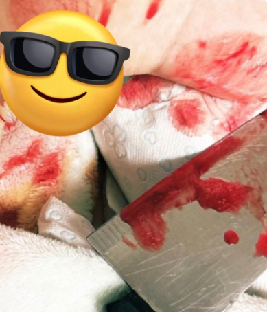 asno_ee_'s tweet photo. Fake suicide attempt. https://t.co/U0XF3XJaUE