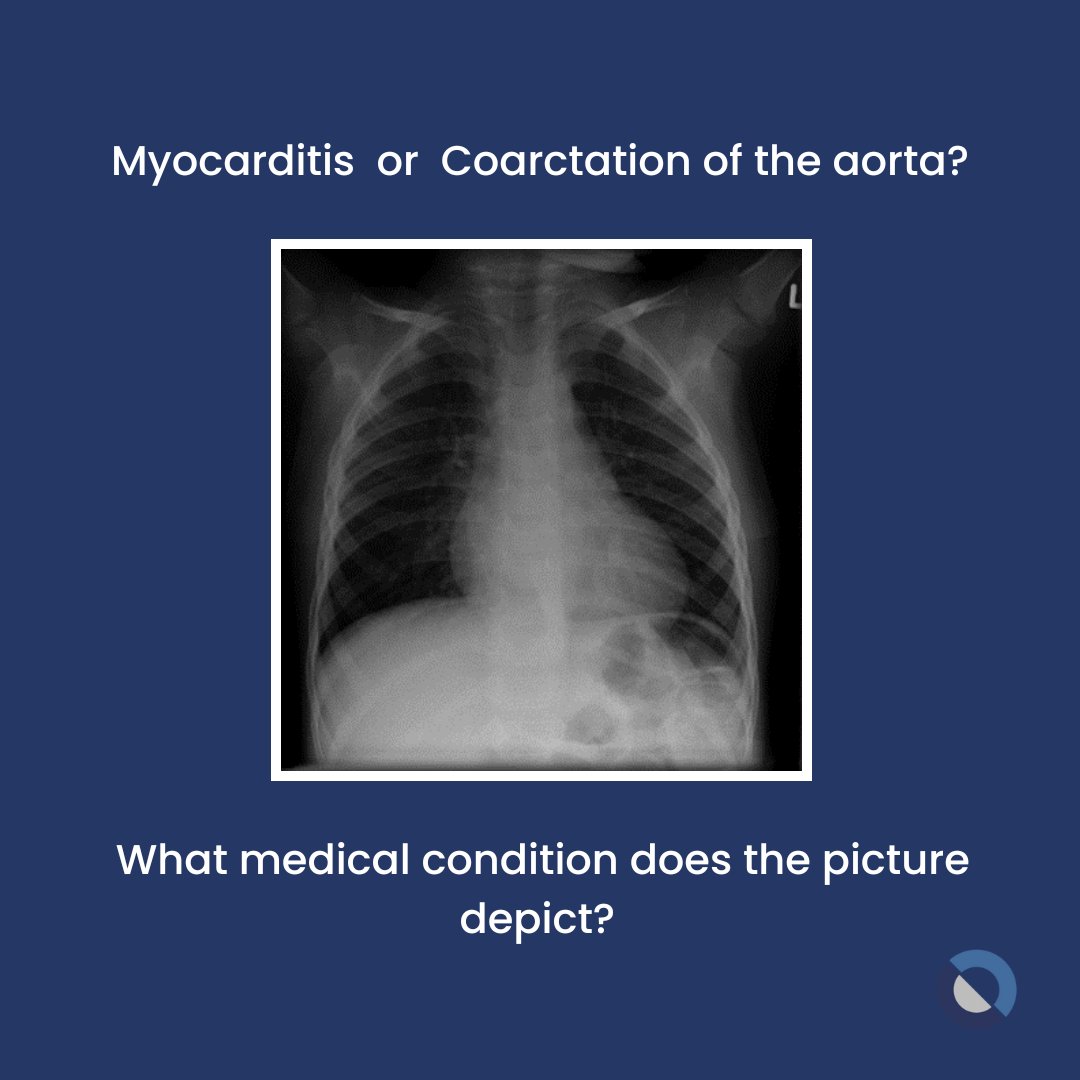 Clue: It is characterized by the narrowing or constriction of the aorta, leading to elevated blood pressure in the upper extremities. The presence of a 'figure of 3' sign is observed on a chest X-ray.

#myocarditis #bloodpressure #chestxray #health #medtigo