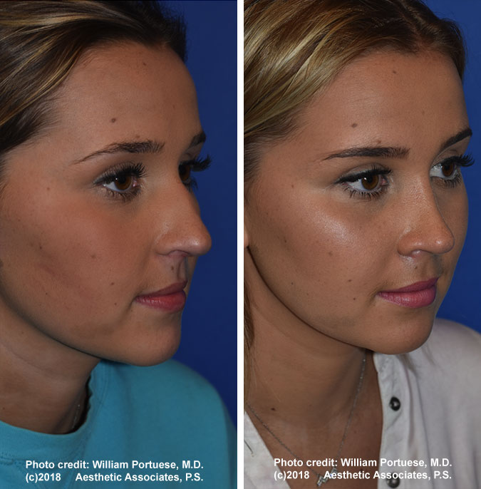 The Portland Center for Facial Plastic Surgery tweet media