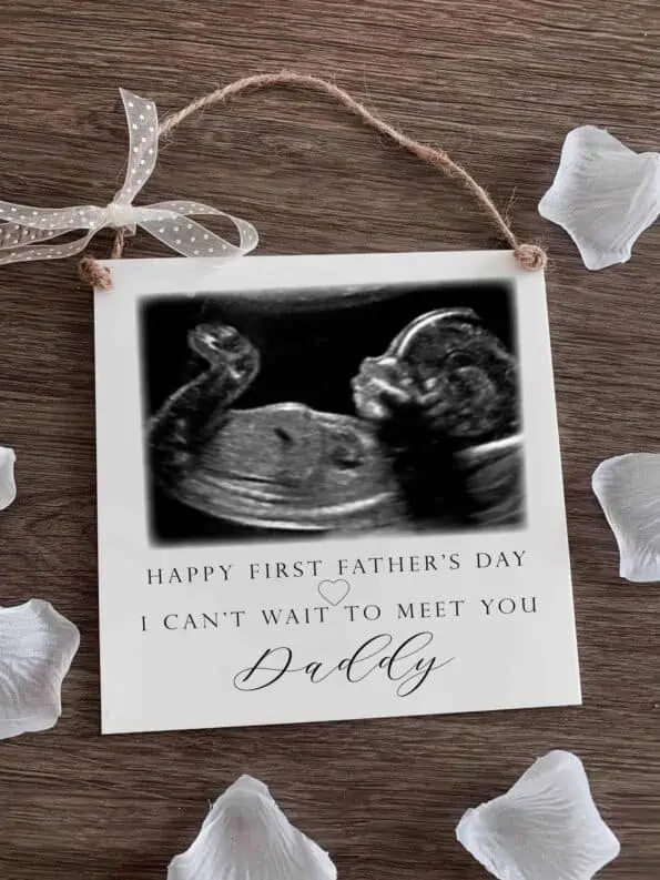 GosforthClinic's tweet photo. Looking for that perfect Fathers' Day #gift?📶https://t.co/N2MFhExqWq📲0191 2841355 💠4DGenderScan £59 📷BabyScans from 6-40 weeks #datingscan #4dscan #baby #pregnant #genderreveal #ultrasound #babygirl #babyboy #scan #boyorgirl #babyshower #Newcastle #twins #FathersDay #Tuesday https://t.co/2jqdSUA06t