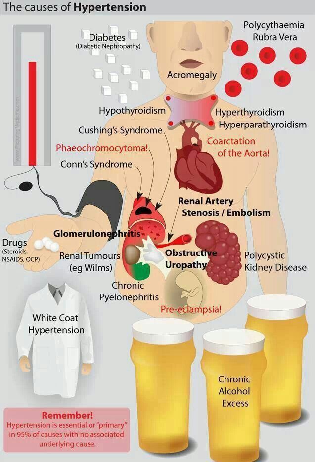 The Causes of Hypertension

#medtwitter #foamed #meded