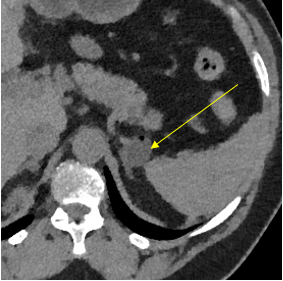 Gopal Punjabi tweet media