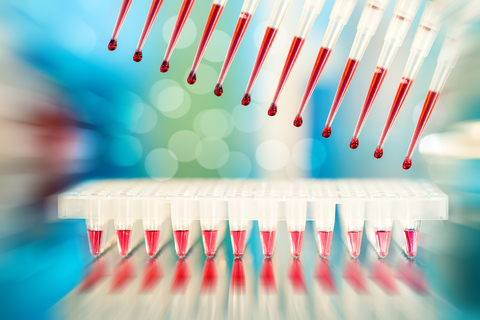 SPCforExcel's tweet image. How do you handle “rare events”? Do control charts work when having rare events? One way to handle rare events is to use a g control chart. What about the individuals control chart? Check it out:

zurl.co/C3S8

#GChart  #IndividualsChart  #AttributeControlChart