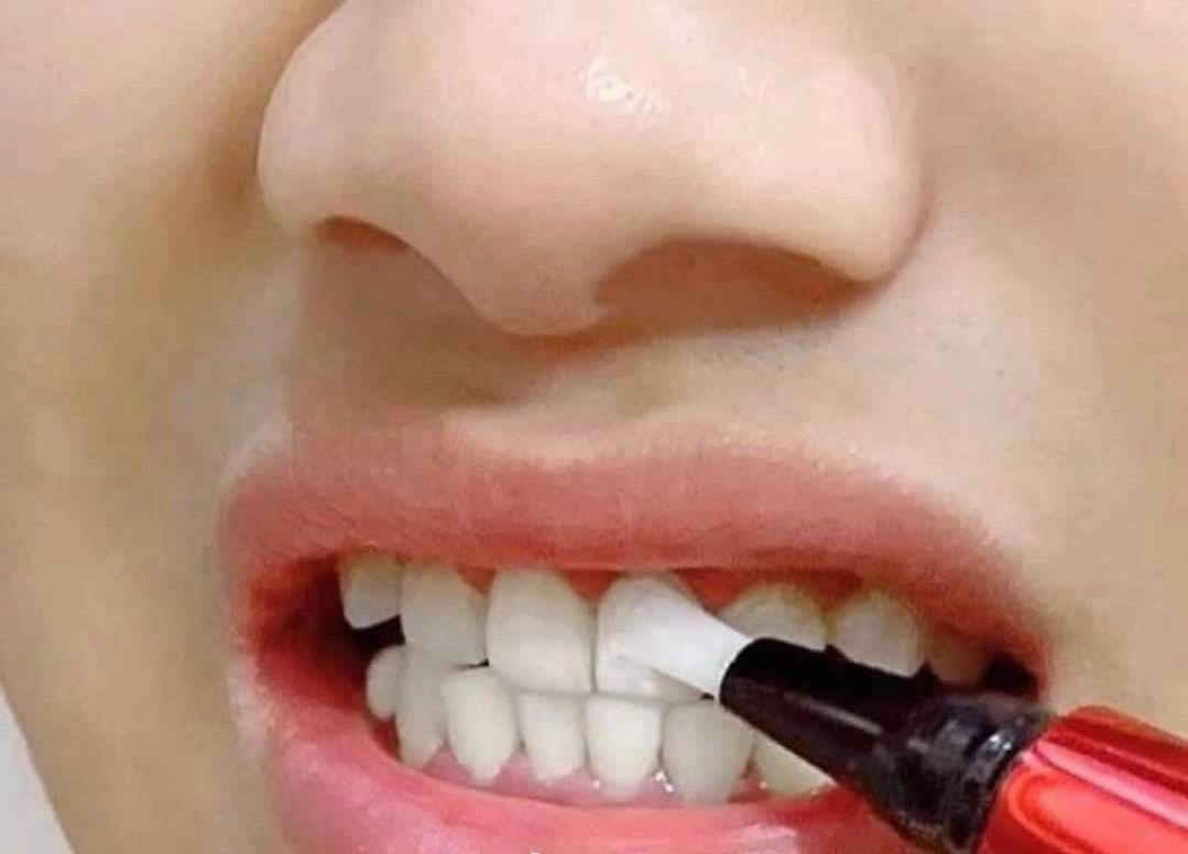 theiceraf's tweet photo. Aku nak share barang baik boleh putihkan gigi dan kekal dalam masa yang lama. 😍😍 Bangun tidur pun mulut still bau wangi dan sangat refreshing. 🫶🏻🫶🏻 https://t.co/yyRj2lS604