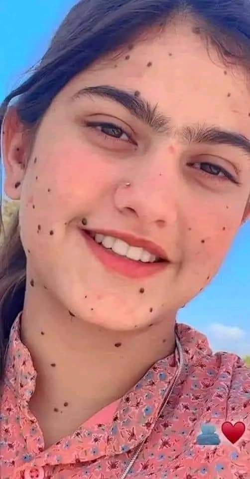 TorbaazT's tweet photo. په مخ دی زخی مزیداری😍😍 
جینی مرداری دلمنځه دی ویستی یمه 😌

@TorbaazT 
@Zahidaf85802102 https://t.co/n6AwHo16wU
