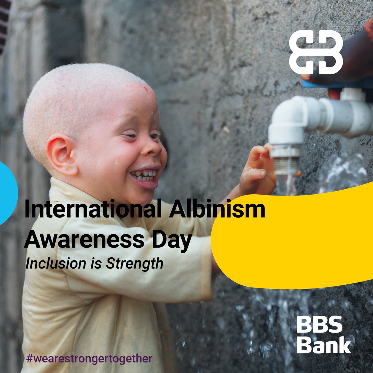 Today we celebrate International #AlbinismDay.

#InclusionIsStrength #InclusiveFuture #AlbinismDay #bbsbank