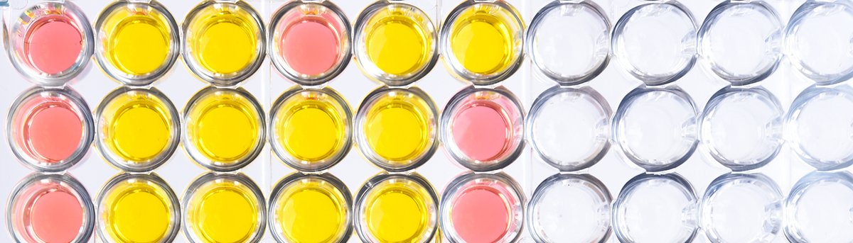 biocompare's tweet image. Optimize your #ELISA workflow with these practical tips on sample prep! Check out this recent Biocompare editorial to ensure accurate and reproducible results. #research #SamplePrep ow.ly/iRsb50OMYVX